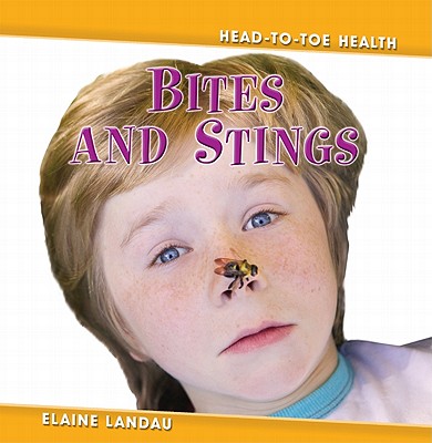 Bites and Stings - Landau, Elaine