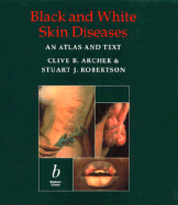 Black and White Skin Diseases: An Atlas and Text