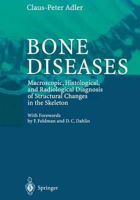 Bone Diseases - Adler, Claus-Peter, and Feldmann, F. (Foreword by), and Dahlin, D.C. (Foreword by)