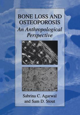 Bone Loss and Osteoporosis: An Anthropological Perspective - Agarwal, Sabrina C. (Editor), and Stout, Samuel D. (Editor)