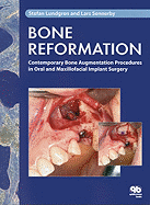 Bone Reformation: Contemporary Bone Augmentation Procedures in Oral and Maxillofacial Implant Surgery