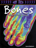 Bones: Injury, Illness and Health - Ballard, Carol, Dr.