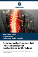 Br?ckenosteotomien bei instrumentierter posteriorer Arthrodese