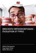 Brackets Orthodontiques: ?volution Et Types