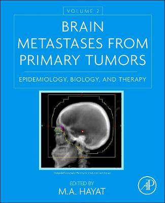 Brain Metastases from Primary Tumors, Volume 2: Epidemiology, Biology, and Therapy - Hayat, M A (Editor)