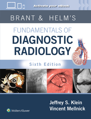 Brant & Helms' Fundamentals of Diagnostic Radiology: Print + eBook with Multimedia - Klein, Jeffrey, MD, Facr, and Mellnick, Vincent