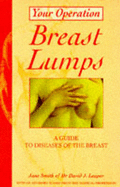 Breast Lumps: A Guide to Diseases of the Breast