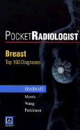 Breast: Top 100 Diagnoses