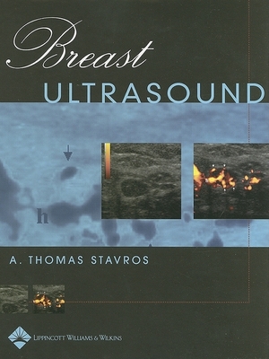 Breast Ultrasound - Stavros, A Thomas, MD