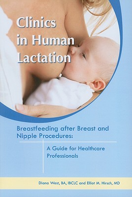 Breastfeeding After Breast and Nipple Procedures: A Guide for Healthcare Professionals - West, Diana, and Hirsch, Elliot M