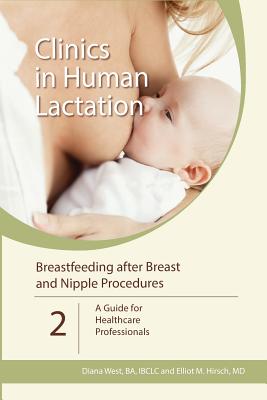 Breastfeeding after Breast and Nipple Procedures: A Guide for Healthcare Professionals - Hirsch, Elliot M, and West, Diana