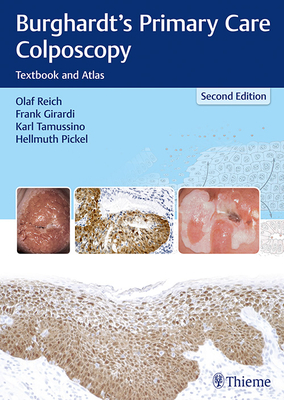 Burghardt's Primary Care Colposcopy: Textbook and Atlas - Reich, Olaf, and Girardi, Frank, and Tamussino, Karl