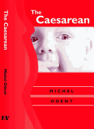 Caesarean, the CB