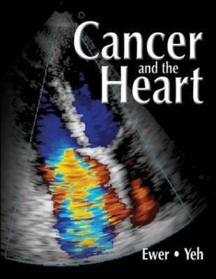 Cancer and the Heart - B C Decker (Creator)