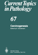 Carcinogenesis