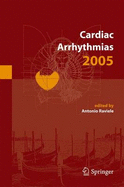 Cardiac Arrhythmias 2005: Proceedings of the 9th International Workshop on Cardiac Arrhythmias (Venice, October 2-5, 2005)
