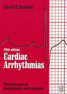 Cardiac Arrhythmias: Practical Notes on Interpretation and Treatment