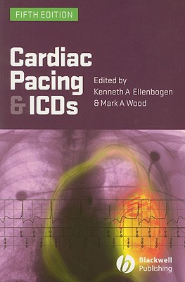 Cardiac Pacing and ICDs - Ellenbogen, Kenneth A, MD, and Wood, Mark A, MD