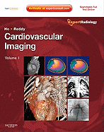 Cardiovascular Imaging, 2-Volume Set: Expert Radiology Series