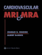 Cardiovascular MRI and Mra