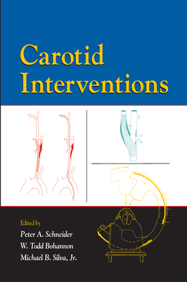 Carotid Interventions - Schneider, Peter (Editor), and Bohannon, Todd (Editor), and Silva, Michael (Editor)