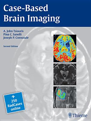 Case-Based Brain Imaging - Tsiouris, Apostolos John, and Sanelli, Pina C, and Comunale, Joseph