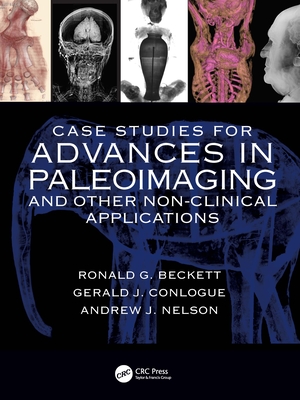 Case Studies for Advances in Paleoimaging and Other Non-Clinical Applications - Beckett, Ronald G, and Conlogue, Gerald J, and Nelson, Andrew