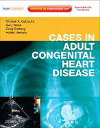 Cases in Adult Congenital Heart Disease - Expert Consult: Online and Print: Atlas