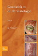 Casu?stiek in de Dermatologie - Deel I