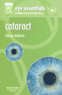 Cataract