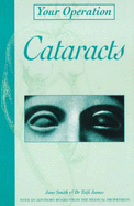 Cataracts