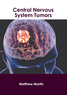Central Nervous System Tumors