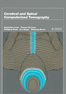 Cerebral and Spinal Computerized Tomography