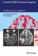 Cerebral MR Perfusion Imaging: Principles and Current Applications