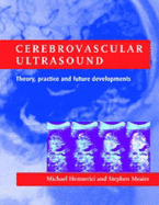 Cerebrovascular Ultrasound: Theory, Practice and Future Developments