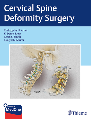 Cervical Spine Deformity Surgery - Ames, Christopher P, and Riew, K Daniel, and Smith, Justin S