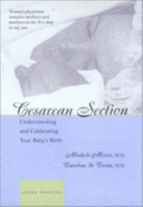 Cesarean Section: Understanding and Celebrating Your Baby's Birth