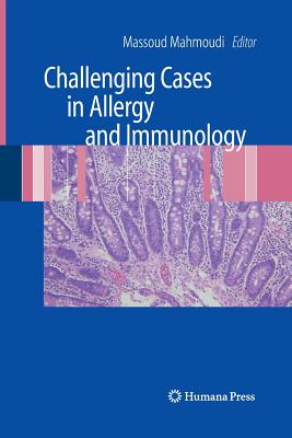 Challenging Cases in Allergy and Immunology - Mahmoudi, Massoud (Editor)