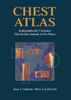 Chest Atlas: Radiographically Correlated Thin-Section Anatomy in Five Planes - Durizch, Mary L, and Callahan, W P, and Lim, W C (Contributions by)