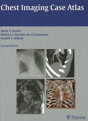 Chest Imaging Case Atlas - Parker, Mark S, and Rosado-De-Christenson, Melissa L, and Abbott, Gerald F
