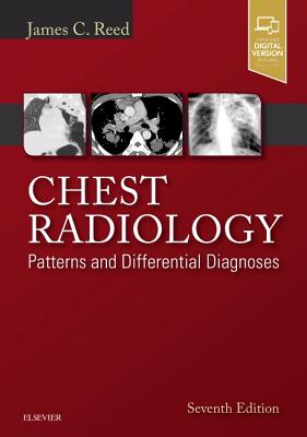 Chest Radiology: Patterns and Differential Diagnoses - Reed, James C., MD