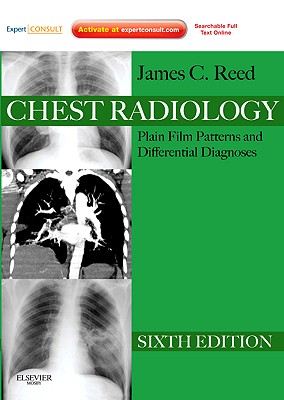 Chest Radiology: Plain Film Patterns and Differential Diagnoses - Reed, James C