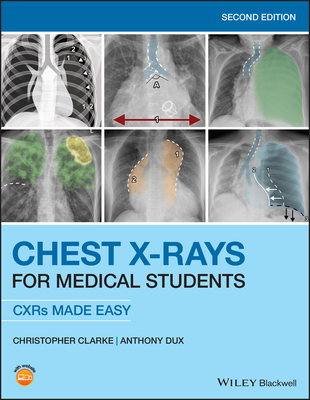 Chest X-Rays for Medical Students: CXRs Made Easy - Clarke, Christopher, and Dux, Anthony