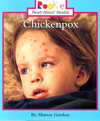 Chickenpox - Gordon, Sharon