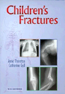 Children's Fractures: A Radiological Guide to Safe Practice - Thornton, Clare, and Gyll, Catherine