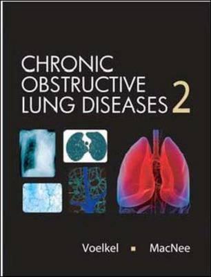 Chronic Obstructive Lung Disease - Voelkel, Norbert F