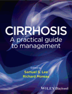 Cirrhosis: A Practical Guide to Management
