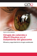 Cirugia de Catarata E Istent Glaukos En El Tratamiento del Glaucoma