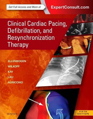 Clinical Cardiac Pacing, Defibrillation and Resynchronization Therapy - Ellenbogen, Kenneth A, MD, and Wilkoff, Bruce L, MD, and Kay, G Neal, MD