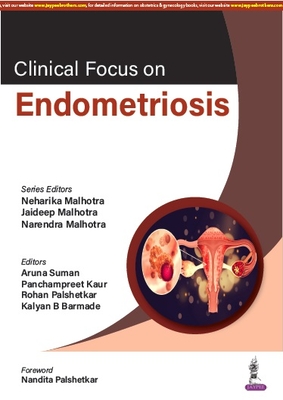 Clinical Focus on Endometriosis - Malhotra, Neharika, and Malhotra, Jaideep, and Malhotra, Narendra